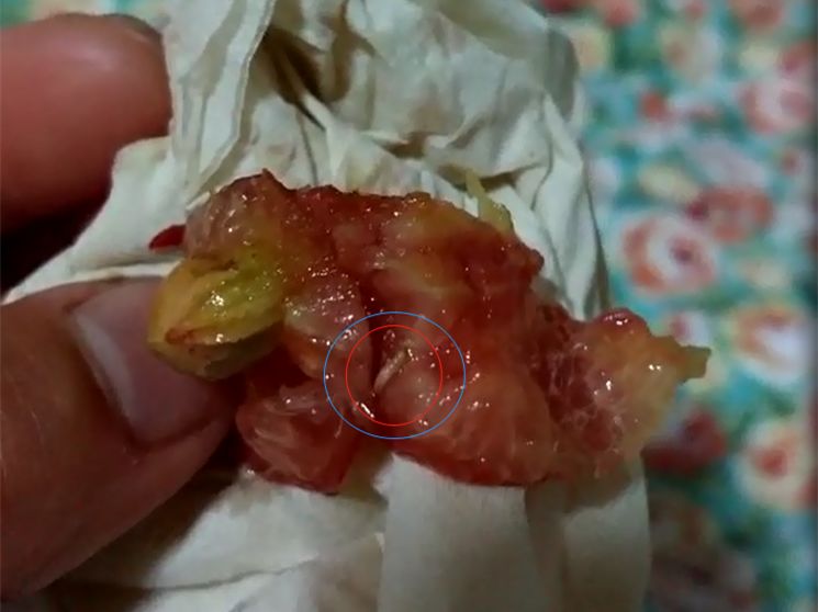 包含为什么没有有一个人敢上去开团啊？全是蛆吗都在后面看？的词条